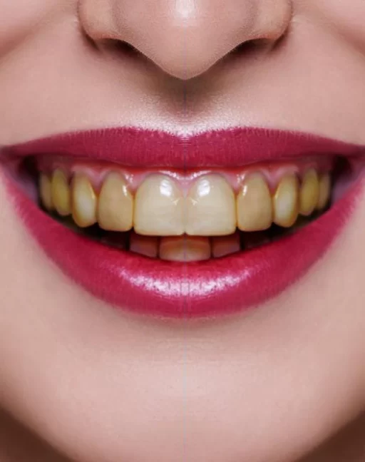 teeth02